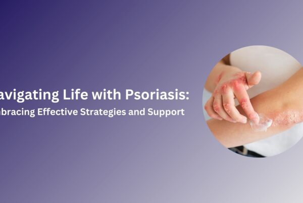 Psoriasis Management