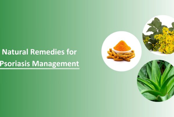 Natural Remedies for Psoriasis Management